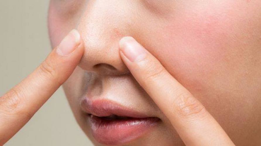 Cara Mengatasi Hidung Tersumbat Dengan Pijatan